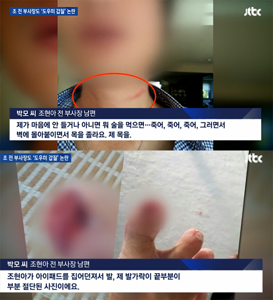 조현아 남편이 폭행 피해 사진을 공개했다. (사진=JTBC 캡처)
