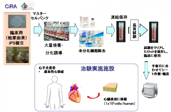 유도만능줄기세포를 이용해 심장근육을 만드는 과정 모식도(그림: 오사카대 발표 자료)