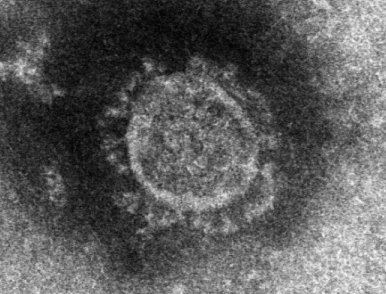 코로나 19 바이러스 (사진제공=질병관리본부)