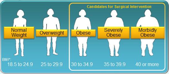 수술이 필요한 비만 단계(사진=Wikimedia)