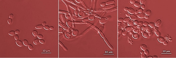 비병원성 캔디다균(왼쪽), 병원성 캔디다균(가운데), 약처리 후 비병원성으로 전환된 병원성 캔디다균(오른쪽) (사진제공=하엘)