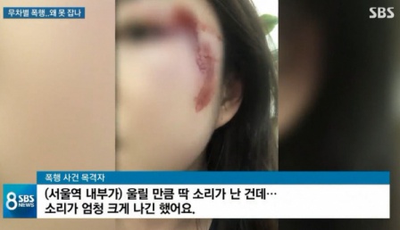 묻지마 폭행 당한 피해 여성의 모습 (사진=SBS 캡처)