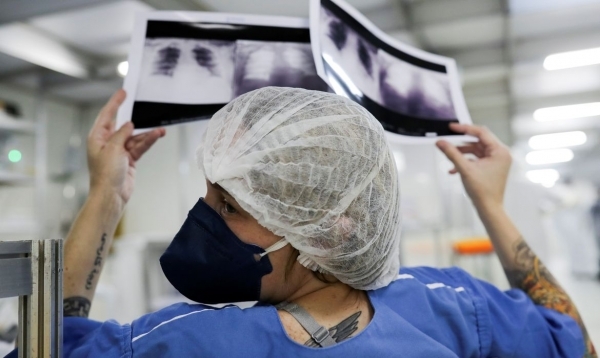 브라질 의료진이 환자의 폐 사진을 판독하고 있다. (사진제공=아젠시아 브라질)