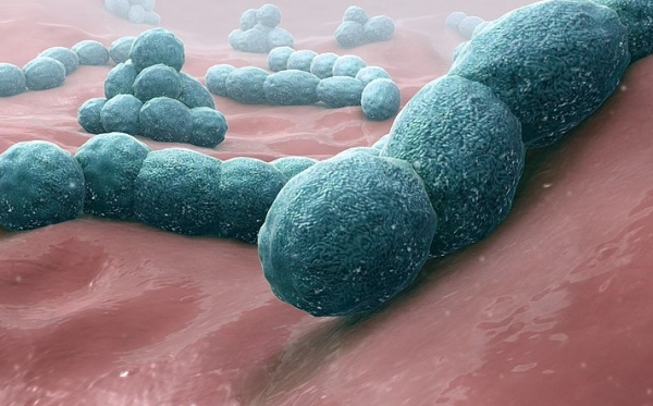 세균성 수막염을 일으키는 박테리아 (이미지=Wikipedia)
