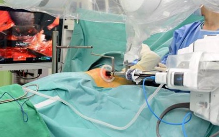 겨드랑이에 작은 구멍 하나를 뚫어 한 개의 관을 통해 수술하는 모습(사진:세브란스병원)