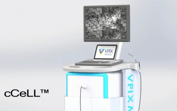 브이픽스메디칼이 개발한 '초소형 공초점 레이저 현미경'
